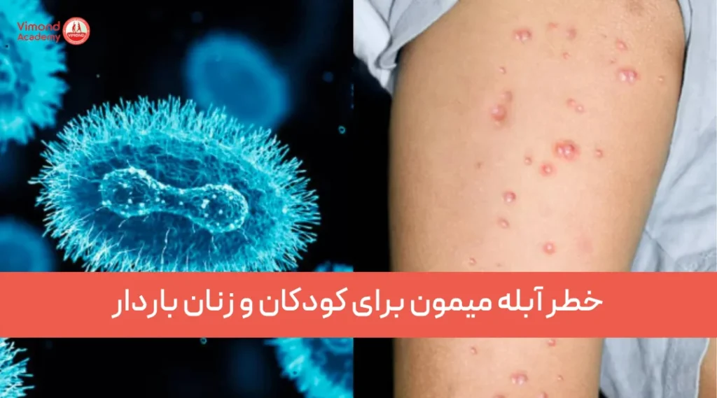 خطر آبله میمون برای کودکان و زنان باردار